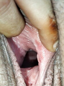 Cum Covered Cervix