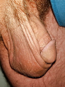 My Penis 8