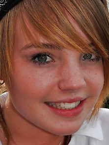 Freckles